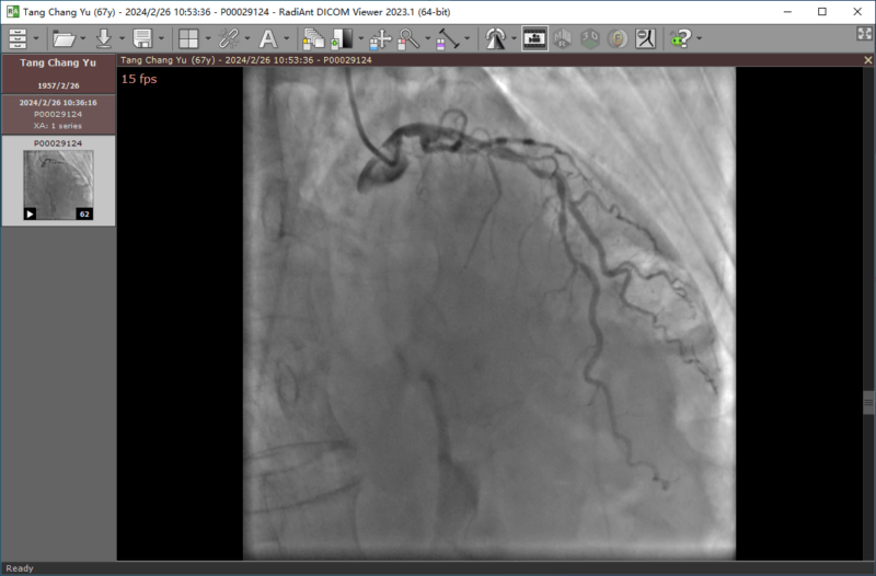 心脏造影视频播放器 破解版 | RadiAnt DICOM Viewer(2025.1)-87软件库|绿色软件+破解游戏下载站